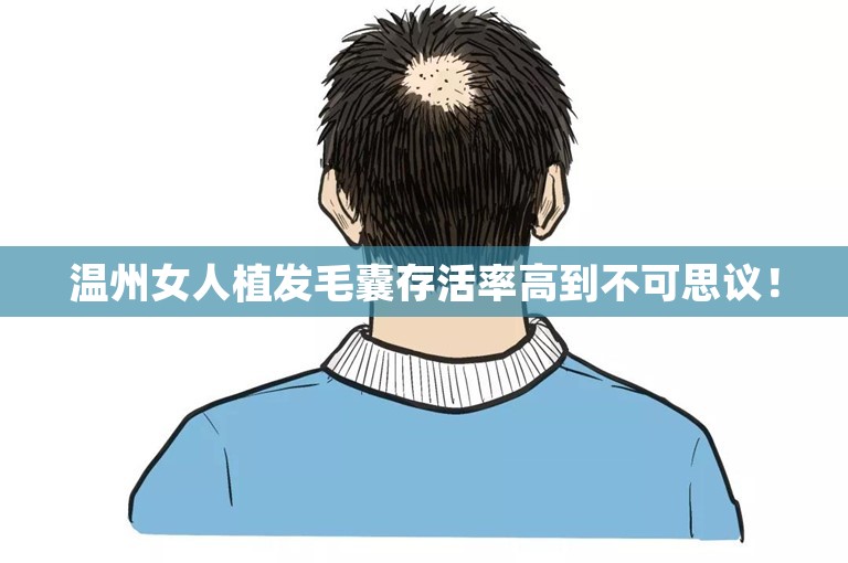 温州女人植发毛囊存活率高到不可思议！