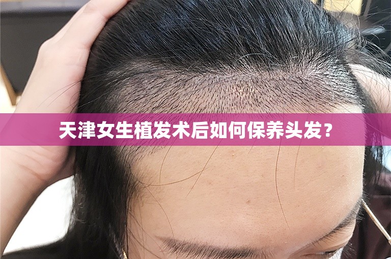 天津女生植发术后如何保养头发？