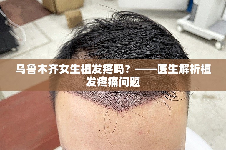 乌鲁木齐女生植发疼吗？——医生解析植发疼痛问题