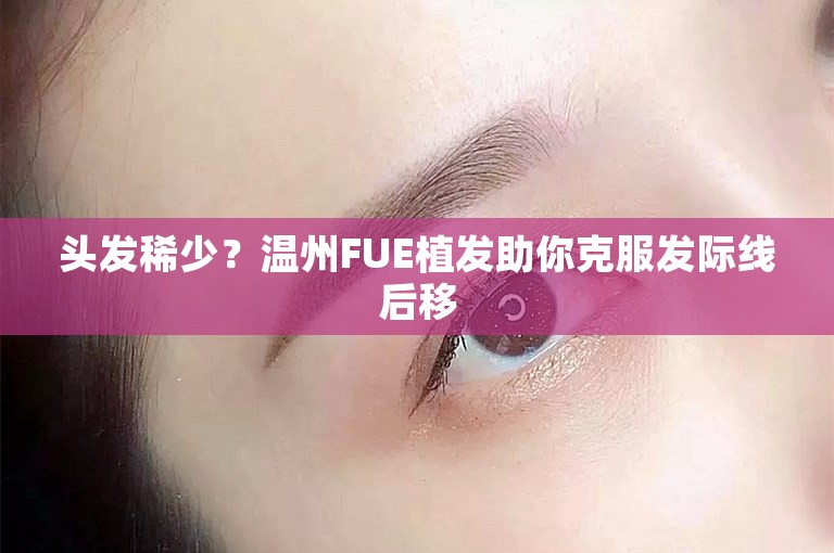 头发稀少？温州FUE植发助你克服发际线后移