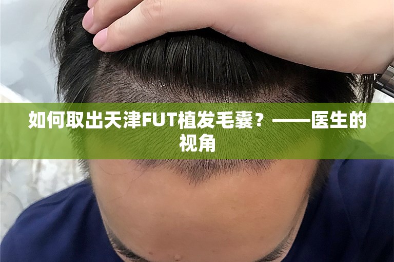 如何取出天津FUT植发毛囊？——医生的视角