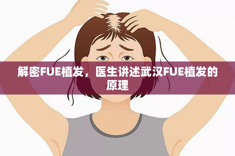 解密FUE植发，医生讲述武汉FUE植发的原理