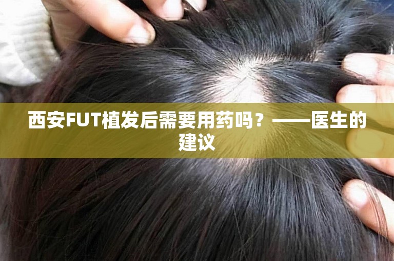 西安FUT植发后需要用药吗？——医生的建议