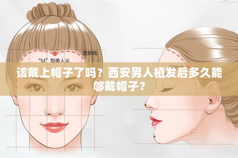 该戴上帽子了吗？西安男人植发后多久能够戴帽子？