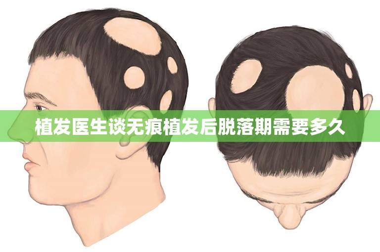 植发医生谈无痕植发后脱落期需要多久