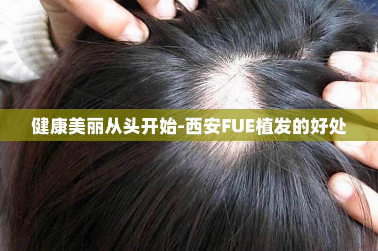 健康美丽从头开始-西安FUE植发的好处