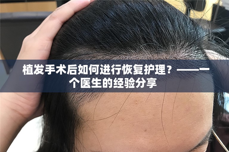  植发手术后如何进行恢复护理？——一个医生的经验分享 