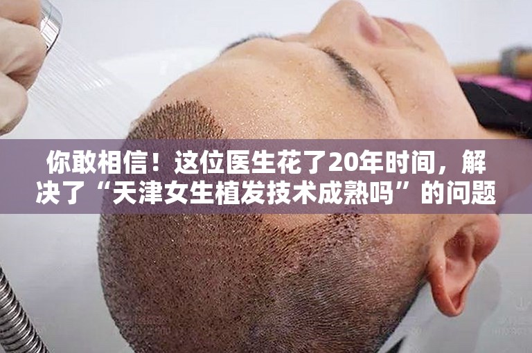 你敢相信！这位医生花了20年时间，解决了“天津女生植发技术成熟吗”的问题！