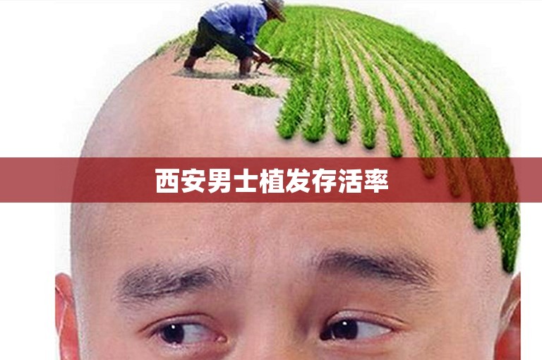 西安男士植发存活率