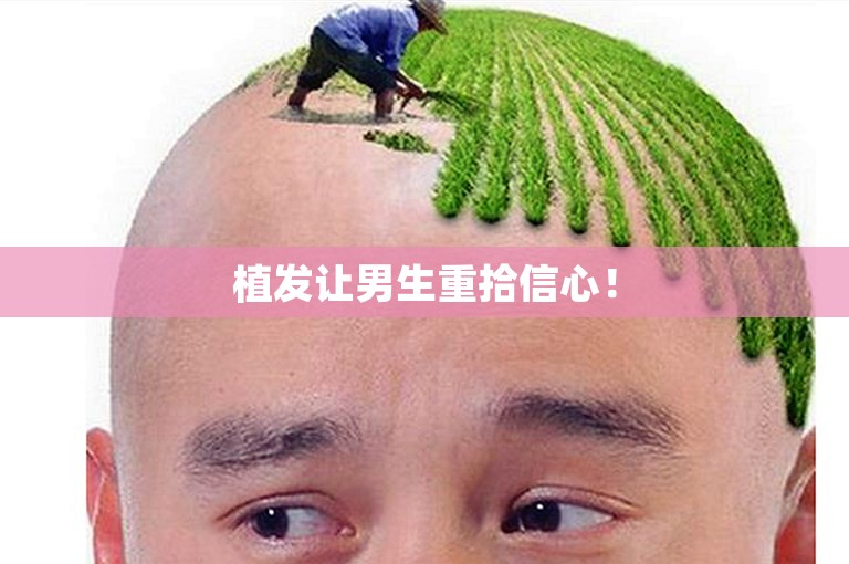 植发让男生重拾信心！