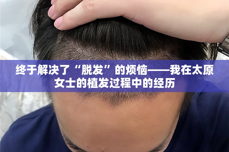 终于解决了“脱发”的烦恼——我在太原女士的植发过程中的经历