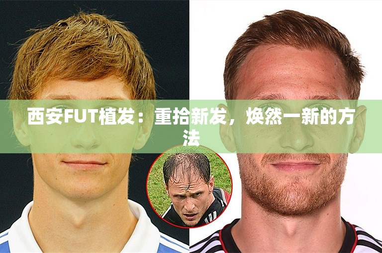 西安FUT植发：重拾新发，焕然一新的方法