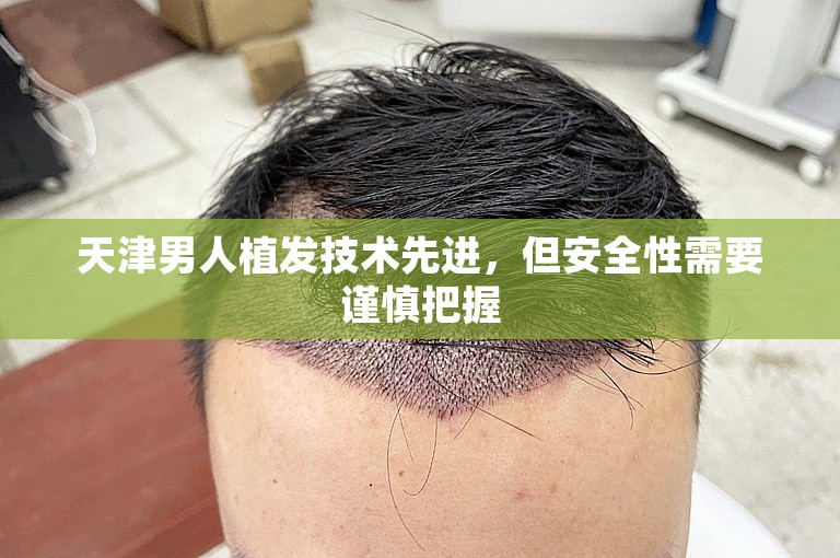 天津男人植发技术先进，但安全性需要谨慎把握