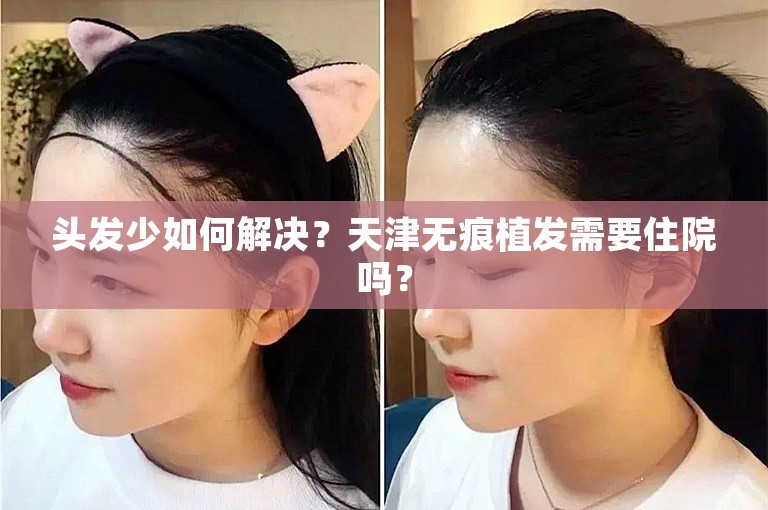 头发少如何解决？天津无痕植发需要住院吗？