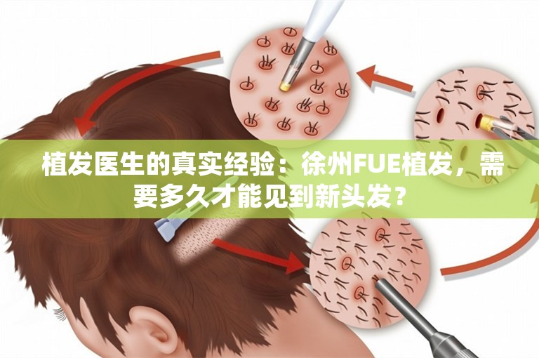  植发医生的真实经验：徐州FUE植发，需要多久才能见到新头发？