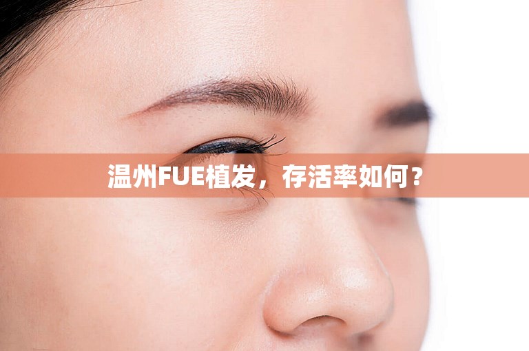 温州FUE植发，存活率如何？