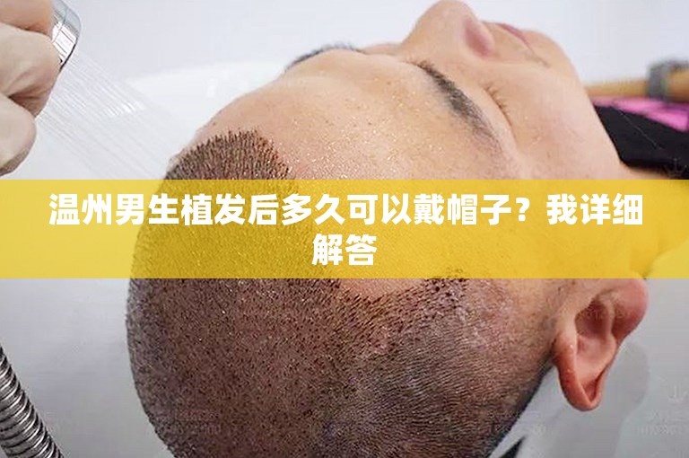 温州男生植发后多久可以戴帽子？我详细解答