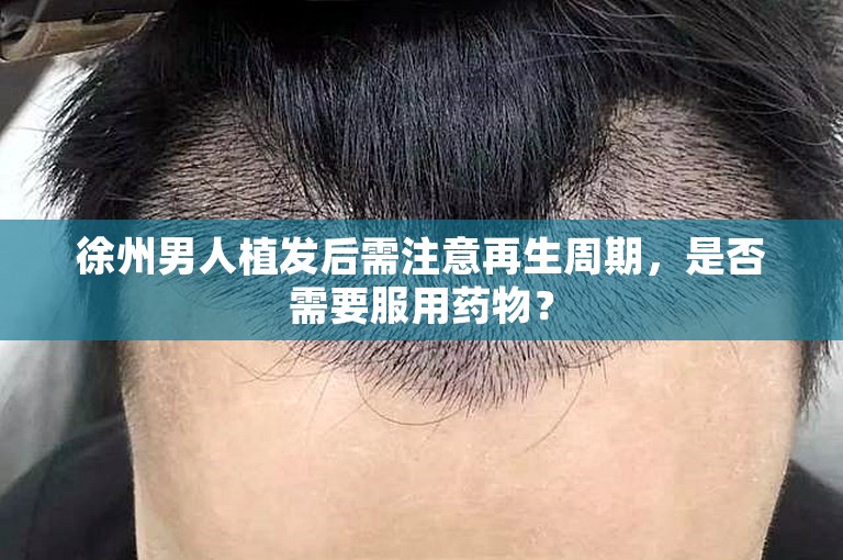 徐州男人植发后需注意再生周期，是否需要服用药物？