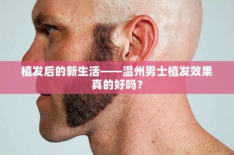 植发后的新生活——温州男士植发效果真的好吗？