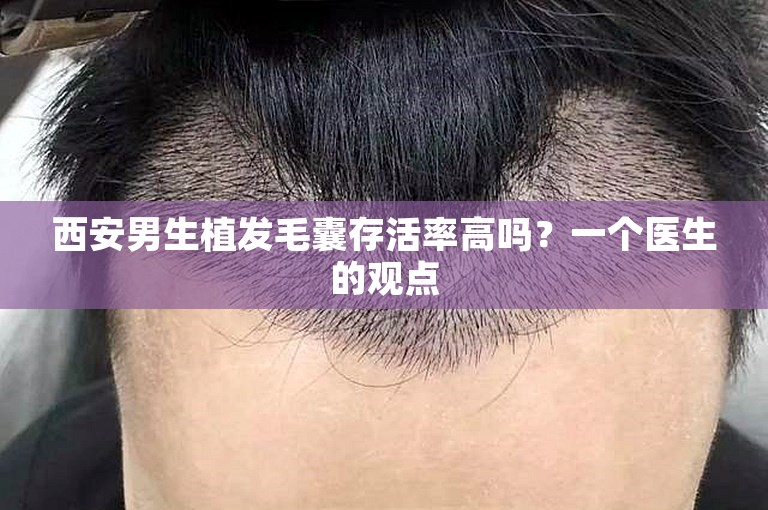 西安男生植发毛囊存活率高吗？一个医生的观点