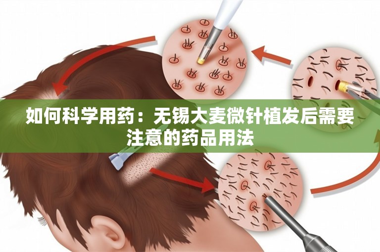 如何科学用药：无锡大麦微针植发后需要注意的药品用法