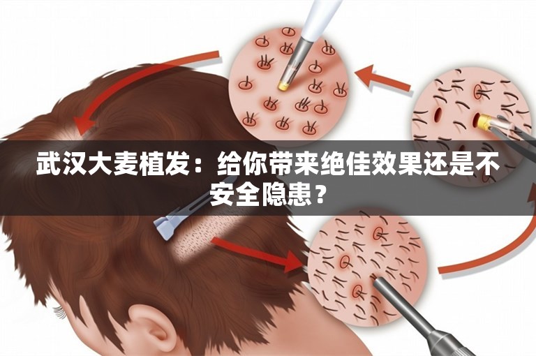 武汉大麦植发：给你带来绝佳效果还是不安全隐患？