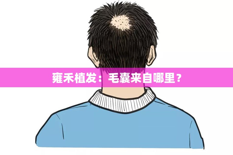 雍禾植发：毛囊来自哪里？