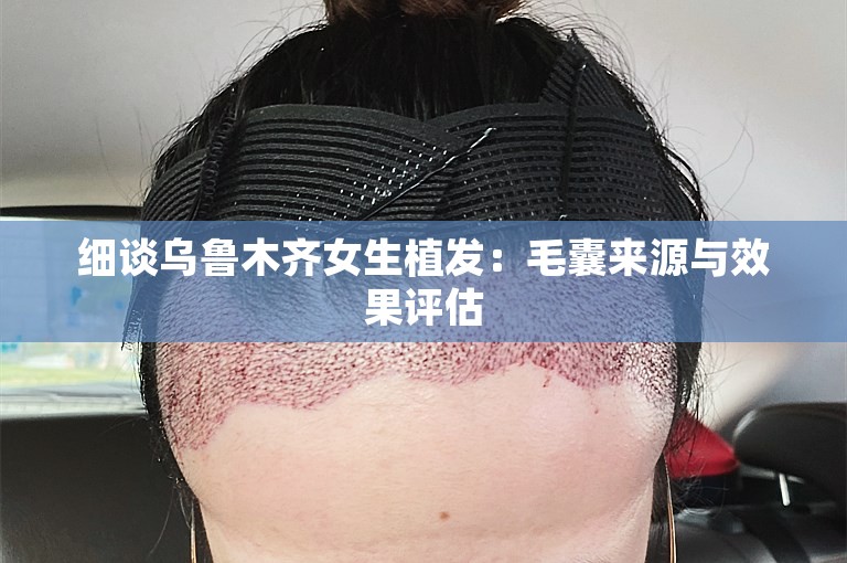 细谈乌鲁木齐女生植发：毛囊来源与效果评估