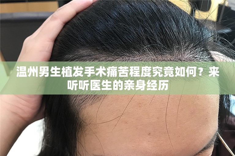 温州男生植发手术痛苦程度究竟如何？来听听医生的亲身经历