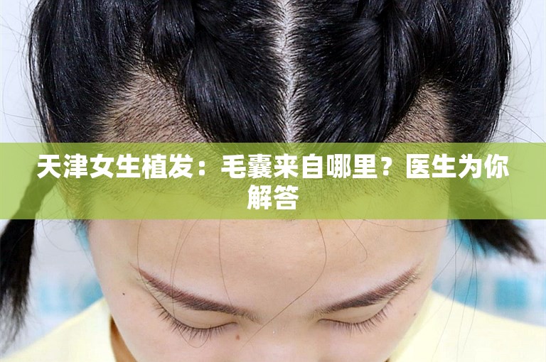 天津女生植发：毛囊来自哪里？医生为你解答