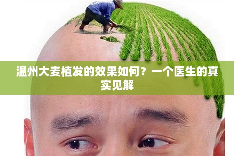 温州大麦植发的效果如何？一个医生的真实见解