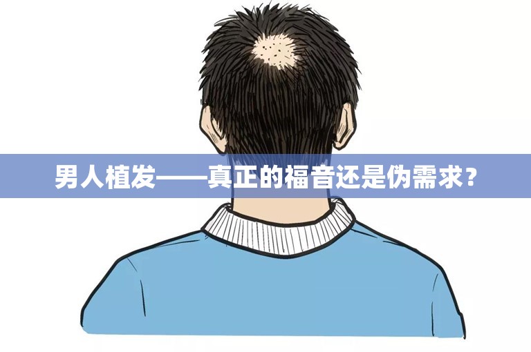 男人植发——真正的福音还是伪需求？