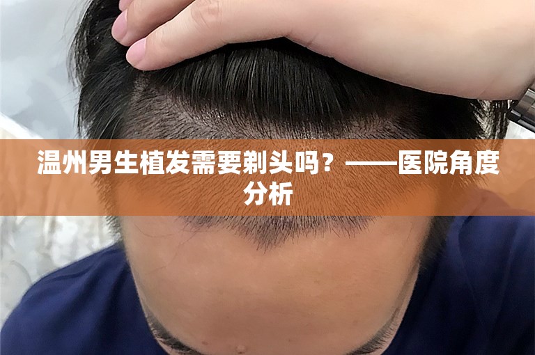 温州男生植发需要剃头吗？——医院角度分析