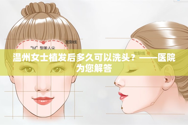 温州女士植发后多久可以洗头？——医院为您解答