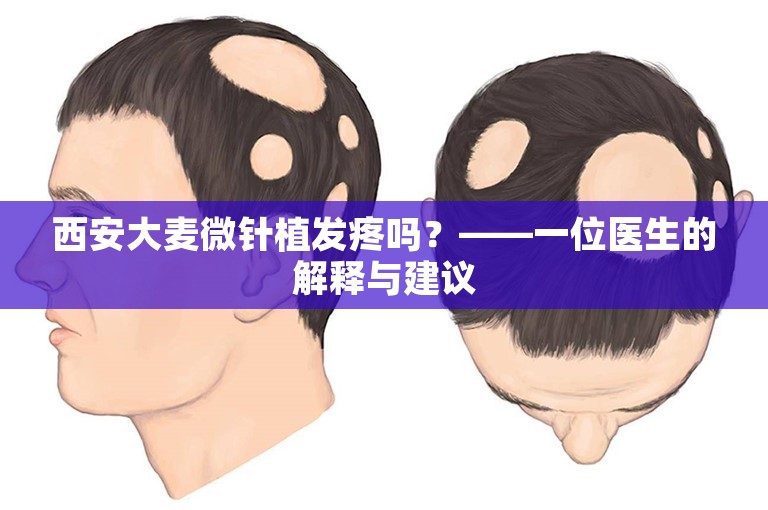 西安大麦微针植发疼吗？——一位医生的解释与建议