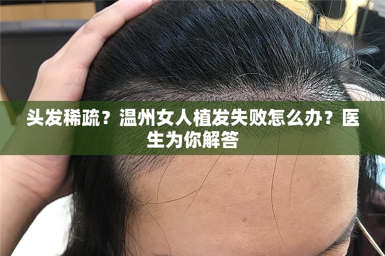 头发稀疏？温州女人植发失败怎么办？医生为你解答