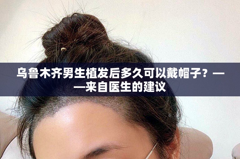 乌鲁木齐男生植发后多久可以戴帽子？——来自医生的建议