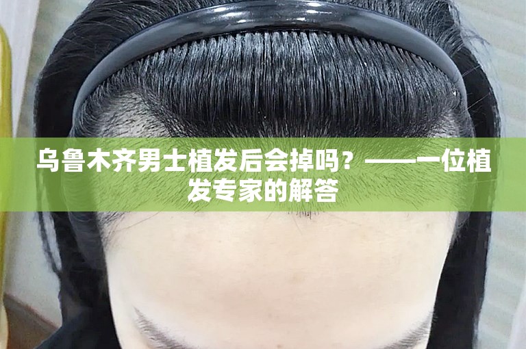 乌鲁木齐男士植发后会掉吗？——一位植发专家的解答