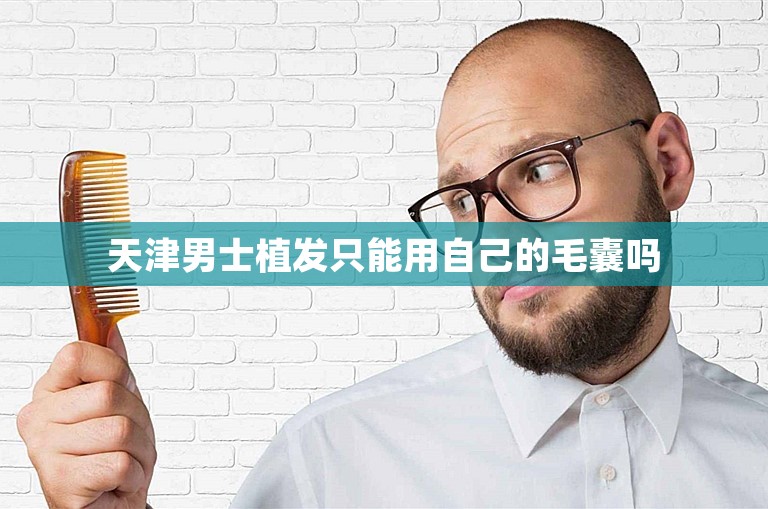 天津男士植发只能用自己的毛囊吗