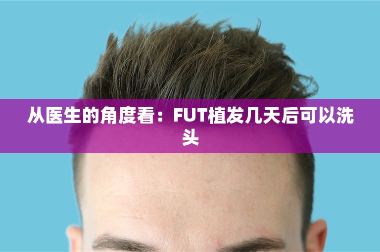 从医生的角度看：FUT植发几天后可以洗头