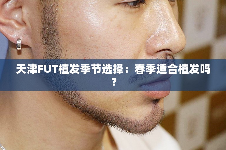 天津FUT植发季节选择：春季适合植发吗？