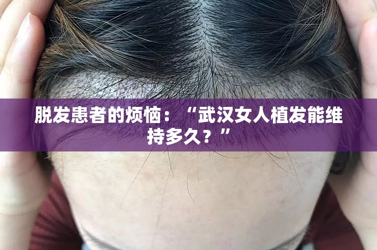 脱发患者的烦恼：“武汉女人植发能维持多久？”