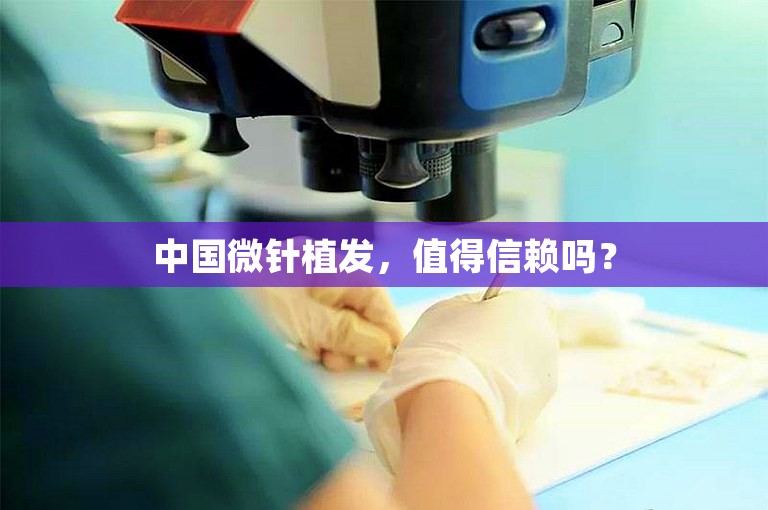 中国微针植发，值得信赖吗？