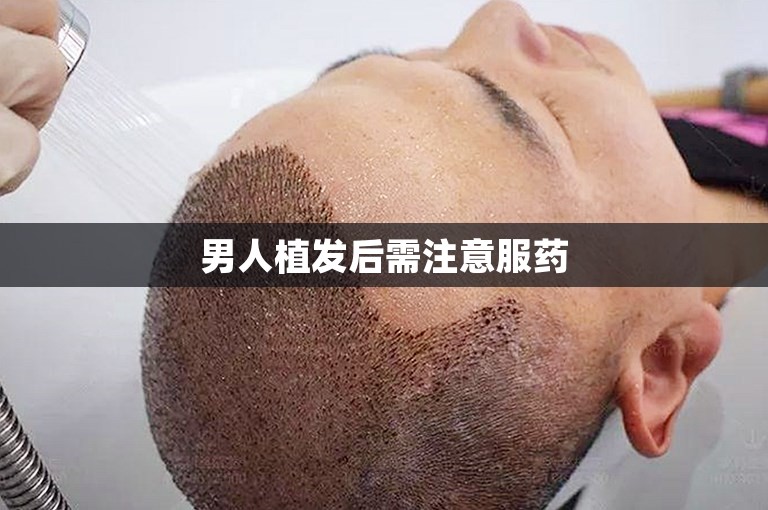 男人植发后需注意服药