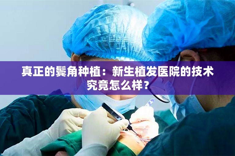 真正的鬓角种植：新生植发医院的技术究竟怎么样？