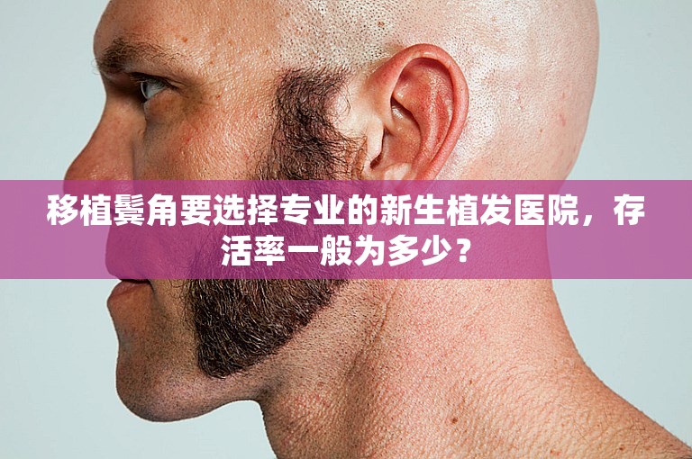 移植鬓角要选择专业的新生植发医院，存活率一般为多少？