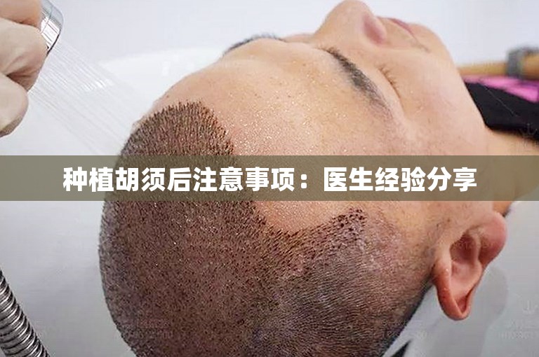 种植胡须后注意事项：医生经验分享