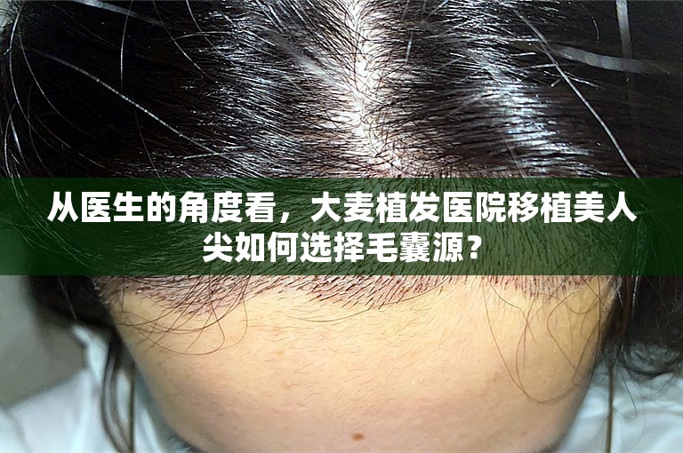 从医生的角度看，大麦植发医院移植美人尖如何选择毛囊源？