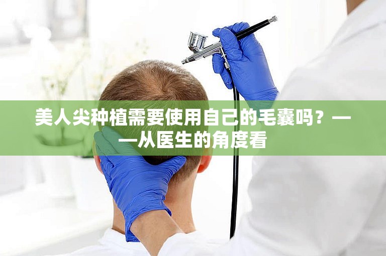 美人尖种植需要使用自己的毛囊吗？——从医生的角度看