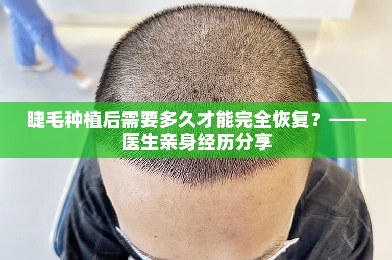 睫毛种植后需要多久才能完全恢复？——医生亲身经历分享